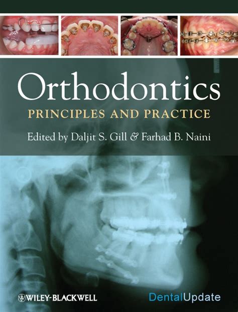 Orthodontics Principles And Practice Ebook Orthodontics Ebook Pdf