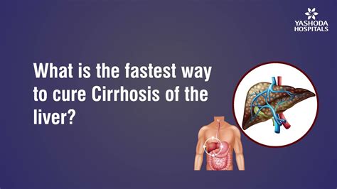 What Is The Fastest Way To Cure Cirrhosis Of The Liver Youtube
