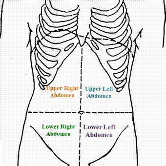 One possible reason for your rib pain could be costochondritis, which is an inflammation of the cartilage that connects a rib to the breastbone. Lower right abdominal pain is not strictly divided based on the gender. It means that both men ...