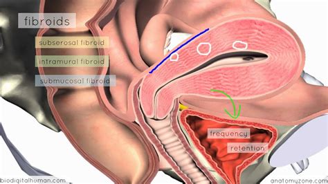 Clinical Reproductive Anatomy Uterus D Anatomy Tutorial Youtube