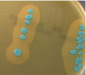 How many serovars of l. Food Microbiologee: August 2012