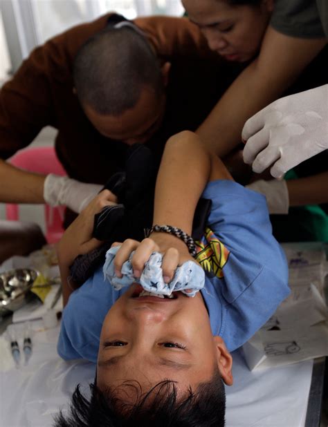 Marikina City Holds Mass Circumcision Inquirer News