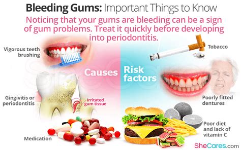 Bleeding Gums Important Things To Know Shecares