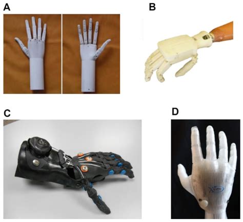 Prosthesis Free Full Text Can Prosthetic Hands Mimic A Healthy