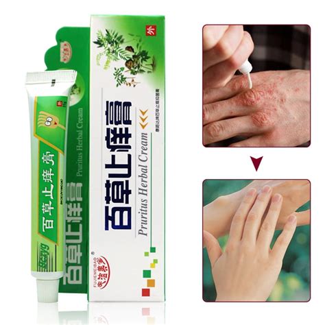 25g Anti Itch Cream Relieves Itching Skin Pruritus Dermatitis Treatment