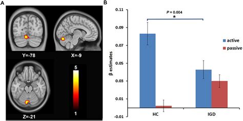 Frontiers Decreased Modulation By The Risk Level On The Brain