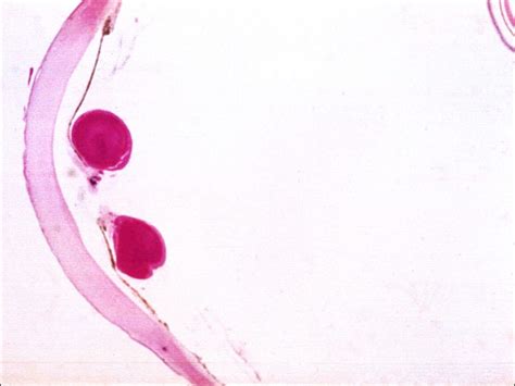 Moran Core Lens Histopathology