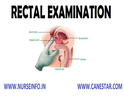Rectal Examination Nurse Info