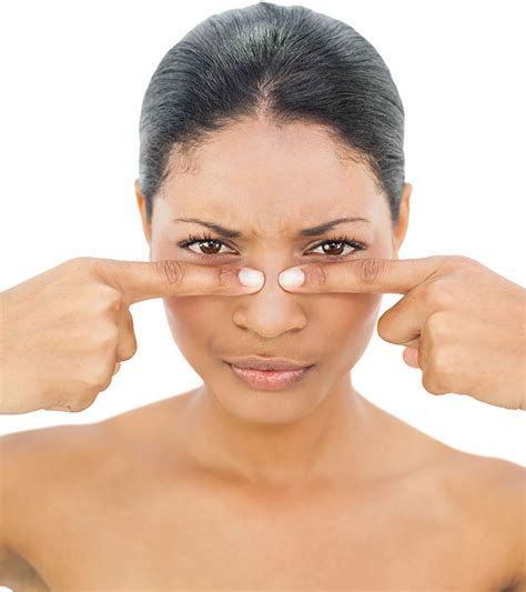 Why we are suggesting prior going into details on how to remove whiteheads from chin, we would like to give some kind of an introduction. How To Remove Blackheads On Nose at Home Fast