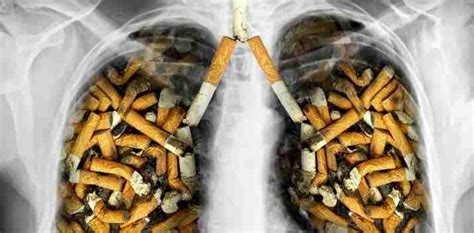 Akibat Merokok Penyakit Kronis Bersarang Pada Organ Tubuh