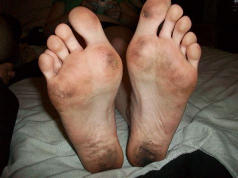 Mypics056 In Gallery Ex Girlfriend Dirty Feet Arse