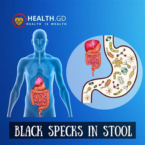 What Causes Black Specks In Stool Healthgd