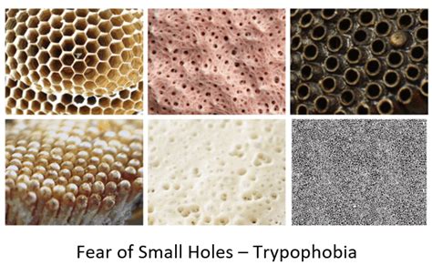 Holes In Skin Disease Trypophobia