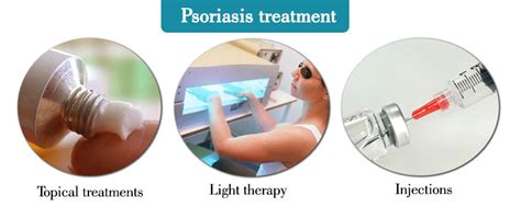 Psoriasis Skin Disease Plaque Psoriasis Scalp Psoriasis And Other Types