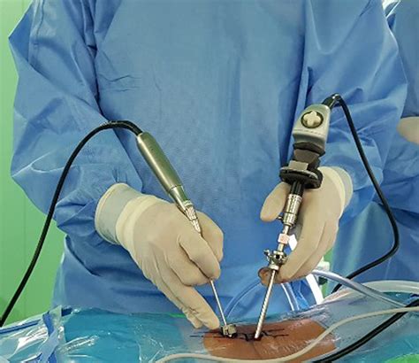 Clinical Results Of Percutaneous Biportal Endoscopic Lumbar Interbody Fusion With Application Of