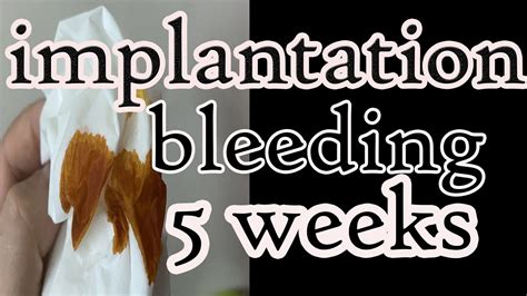 Implantation Bleeding 5 Weeks Youtube