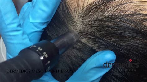 First priority should be to recognize and treat identifiable causes of hair loss, such as medications, infections, nutritional deficiencies, medical conditions or hormonal imbalances. Undiscovered gem for hair loss - DERMEDICS Meso Hair ...