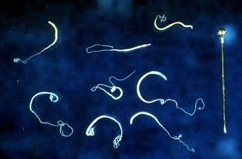 Whipworm infestation in cats is generally treated on an outpatient basis as the medication for whipworms is generally easy to administer. Questions On Dogs and Cats: ANOTHER DAY (YEAR) OLDER....