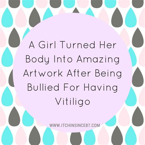 Skin Infogirl Turned Body Amazing Artwork Bullied Vitiligo Amazing