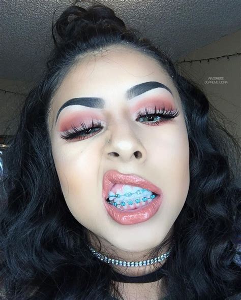 Pinterest Supreme Cora🎭 Brace Face Cute Braces Colors Cute Braces