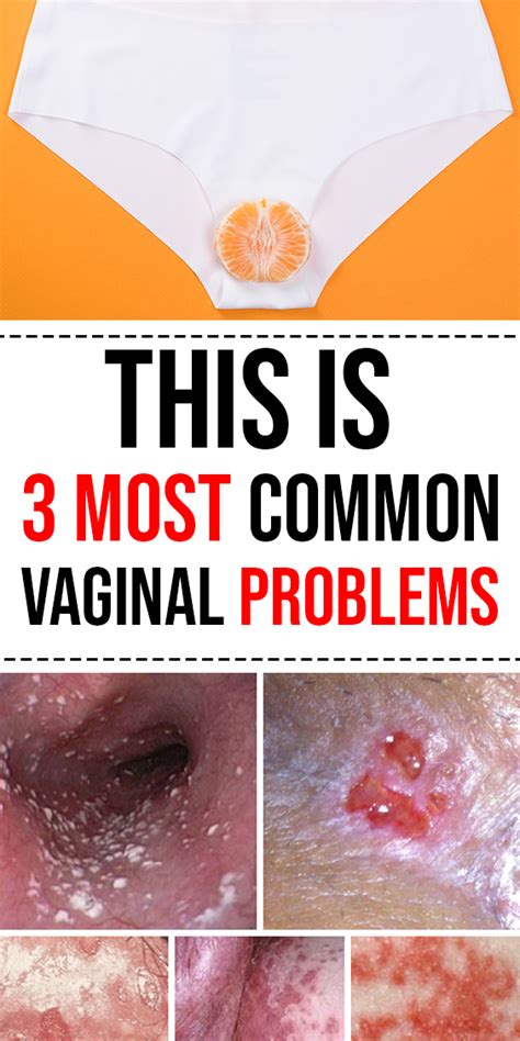 This Is 3 Most Common Vaginal Problems Healthy Free