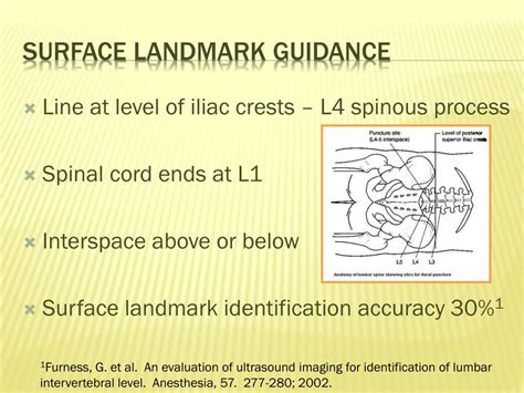 Ppt Ultrasound Guided Lumbar Puncture Powerpoint Presentation Free