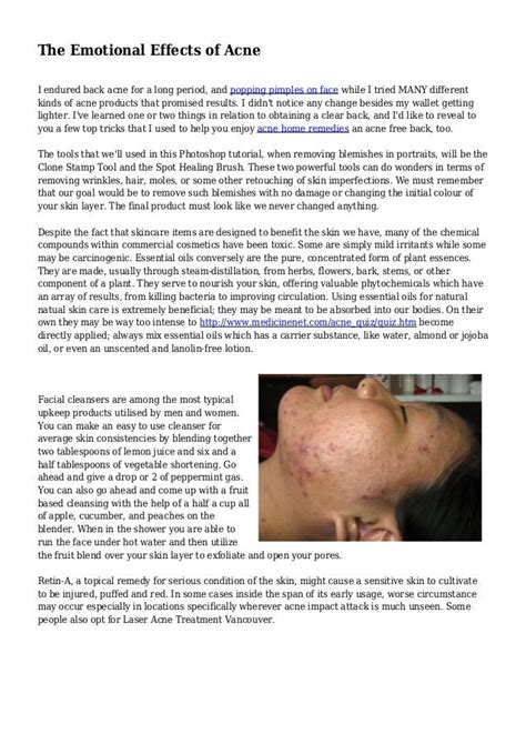 The Emotional Effects Of Acne
