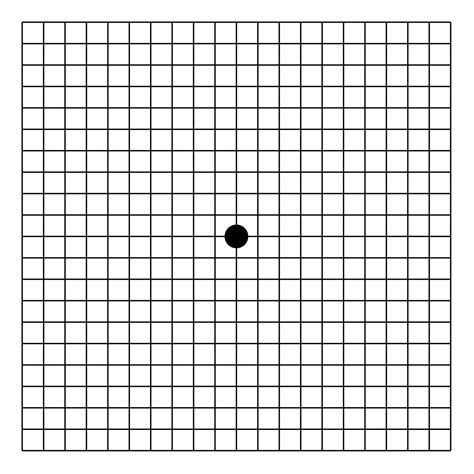 Liegt eine einschränkung ihres sehens vor, so wird das gitter von einem betroffenen auge mit verzerrten und unterbrochenen linien. Amsler grid - Wikipedia