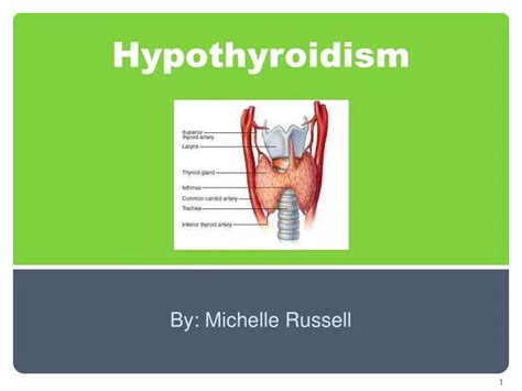Ppt Hypothyroidism Powerpoint Presentation Free Download Id1999747