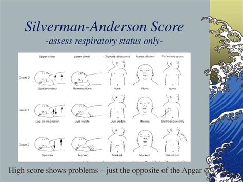 Ppt Neonatal Assessment Powerpoint Presentation Free Download Id