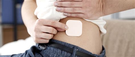 The contraceptive patch