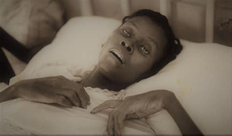 A Haitian AIDS Victim Rests On A Hospital Bed 1993 The Height Of The