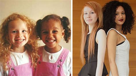 Twin Girls Born With Different Skin Colors Have To Prove Theyre