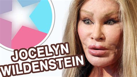 Jocelyn Wildenstein Before And After Then And Now Changing Face