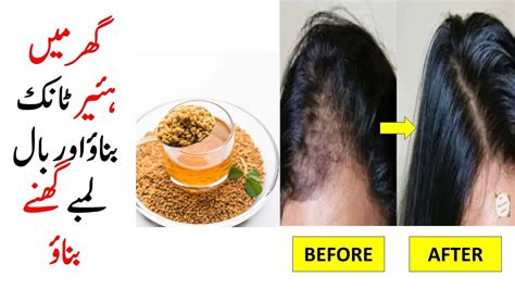 Rice And Methi Hair Pack Best Home Remedy For Hair Fall Treatment For
