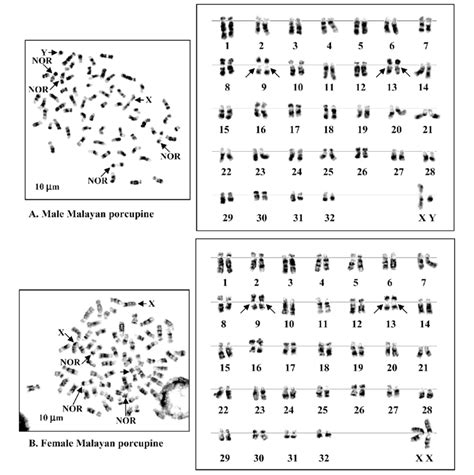 Metaphase Chromosome Plates And Karyotypes Of Male A And Female B Download Scientific