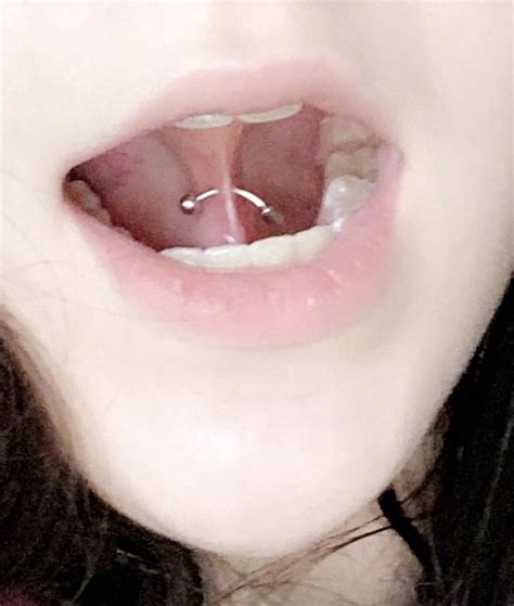 tongue web piercing infection