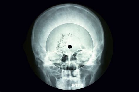 Soviet Era Bootleg Music Recorded On Discarded X Ray Plates New Scientist