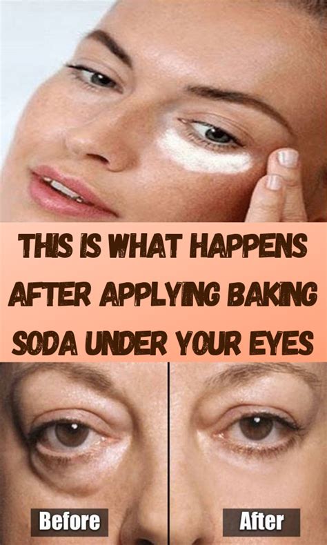 Pin By Leslie Devol On Health Tips Puffy Eyes Remedy Puffy Eyes