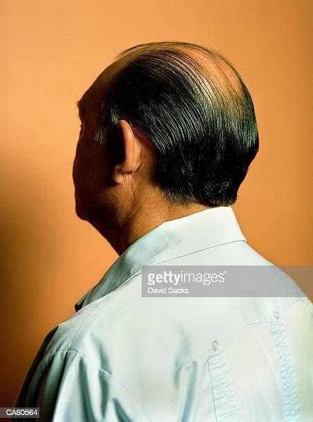 Balding Comb Over Photos And Premium High Res Pictures Getty Images