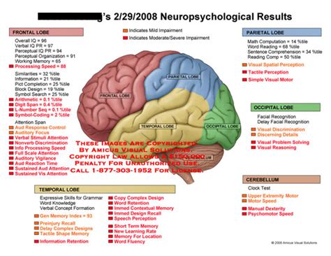 List Of Neurological Deficits Along With Color Coded Brain