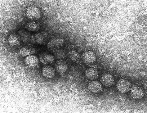 Free Picture Electron Micrograph West Nile Virus