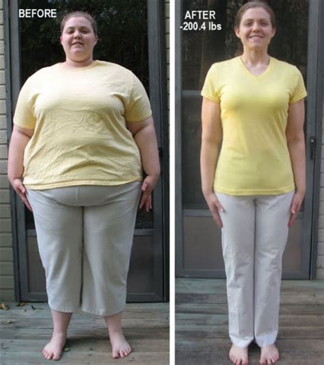 Fat People Who Slimmed Down Before And After 35 Pics