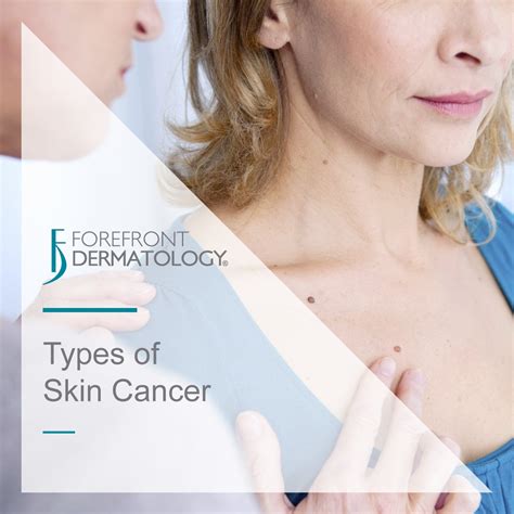 Types Of Skin Cancer Forefront Dermatology