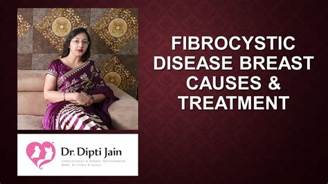 Fibrocystic Disease Breast Causes And Treatment Youtube