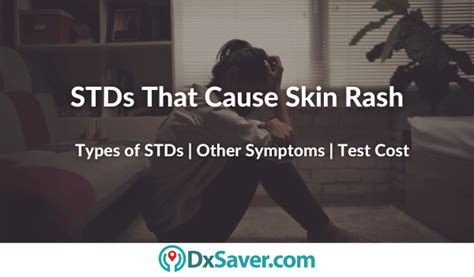 Types Of Stds That Cause Rash On Body And Other Std Symptoms Health