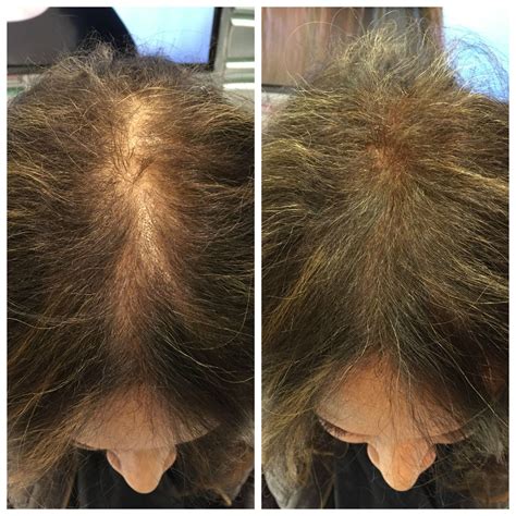 The brand can be found on shelves in over 25,000 retail locations across america. #Viviscal Hair Filler Fibers demos at #ABS2015 @ABSUpdates ...