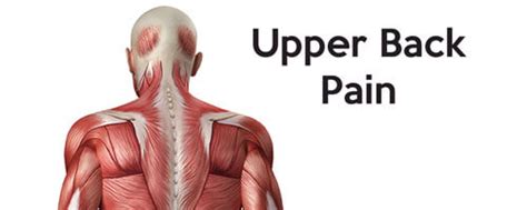 630 anatomical structures of the upper limb (pectoral girdle, shoulder, arm, elbow, forearm, wrist terminologia anatomica: Soluzione alla cervicale