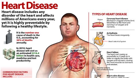 The 8 Types Of Heart Disease Dr Sam Robbins