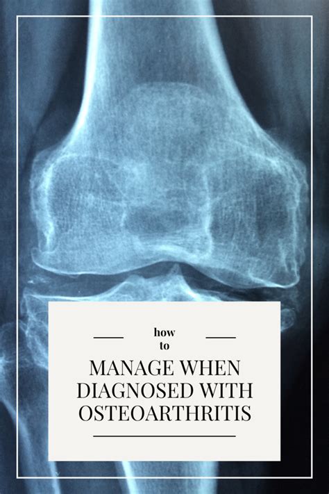 How To Manage Your Lifestyle When Diagnosed With Osteoarthritis I Do